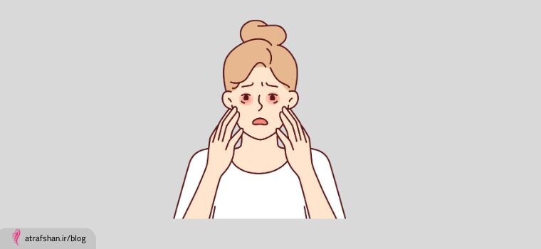 حساسیت پوستی ناشی از عطر